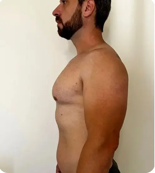 Mitchell Johnston after progress with Ongo Weight Loss