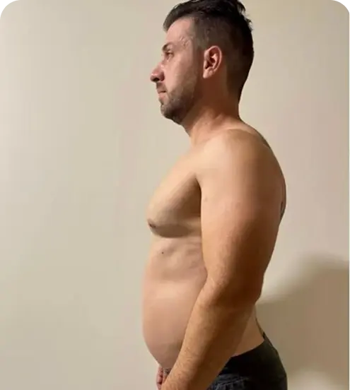 Mitchell Johnston before starting Ongo Weight Loss